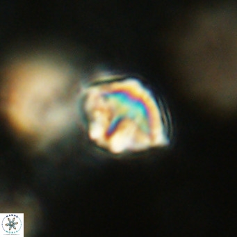 Discoaster artatus VR 18301