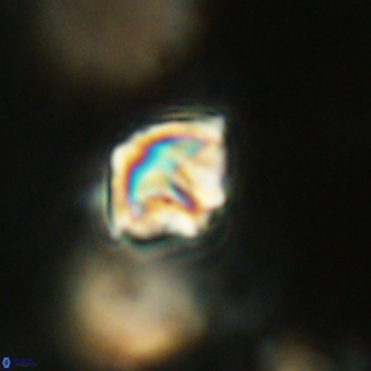 Discoaster artatus VR 18304