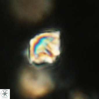 Discoaster artatus VR 18304