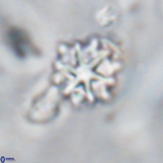 Discoaster artatus VR 18306