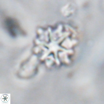 Discoaster artatus VR 18306