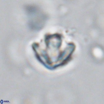 Discoaster artatus VR 18307