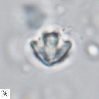 Discoaster artatus VR 18307