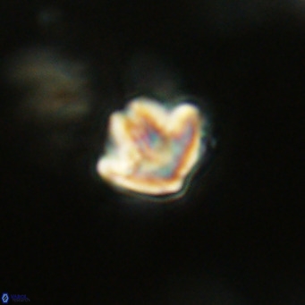 Discoaster artatus VR 18308