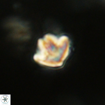 Discoaster artatus VR 18308