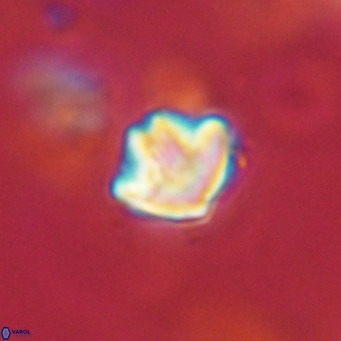 Discoaster artatus VR 18309