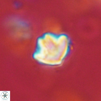 Discoaster artatus VR 18309