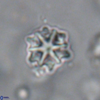 Discoaster artatus VR 18316