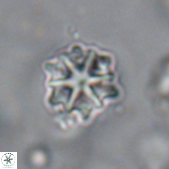 Discoaster artatus VR 18316