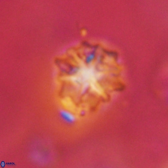 Discoaster artatus VR 18318