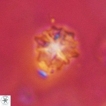 Discoaster artatus VR 18318