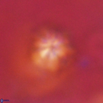 Discoaster artatus VR 18320