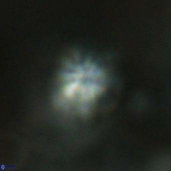 Discoaster artatus VR 18321