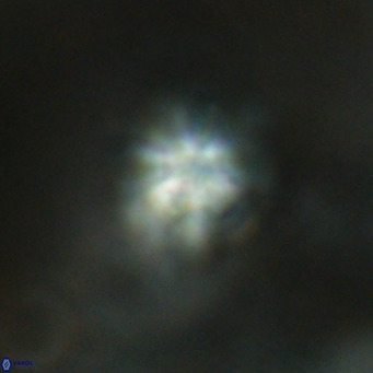 Discoaster artatus VR 18322