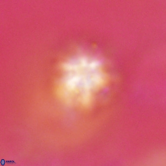 Discoaster artatus VR 18323