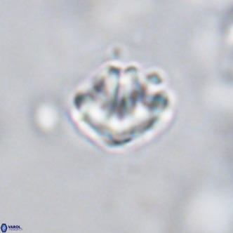 Discoaster artatus VR 18328