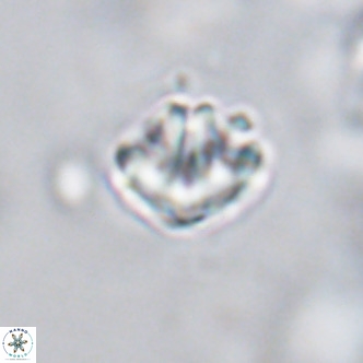 Discoaster artatus VR 18328