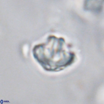 Discoaster artatus VR 18329