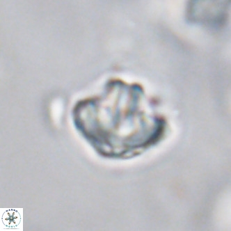 Discoaster artatus VR 18329