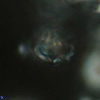 Discoaster artatus VR 18338