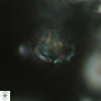 Discoaster artatus VR 18338