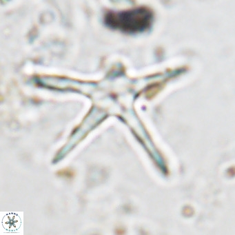 Discoaster asymmetricus VR 08203