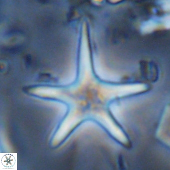 Discoaster asymmetricus VR 10121