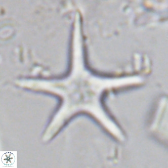 Discoaster asymmetricus VR 10122