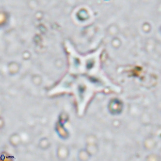 Discoaster asymmetroivrachiones VR 17835