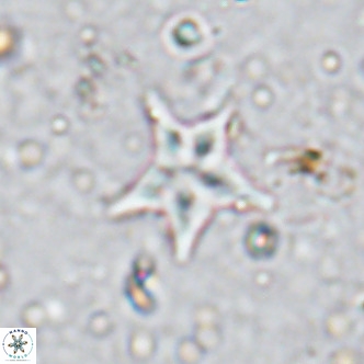Discoaster asymmetroivrachiones VR 17836