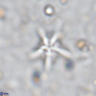 Discoaster asymmetroivrachiones VR 17837