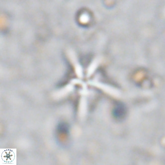 Discoaster asymmetroivrachiones VR 17837