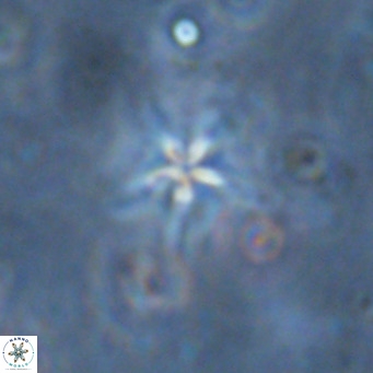 Discoaster asymmetroivrachiones VR 17838
