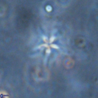 Discoaster asymmetroivrachiones VR 17836