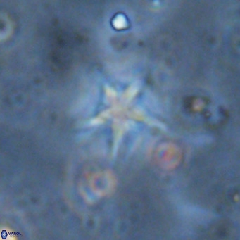 Discoaster asymmetroivrachiones VR 17839