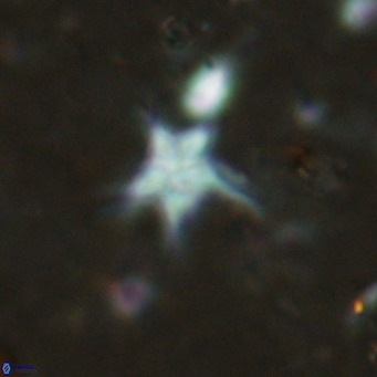 Discoaster asymmetroivrachiones VR 17844