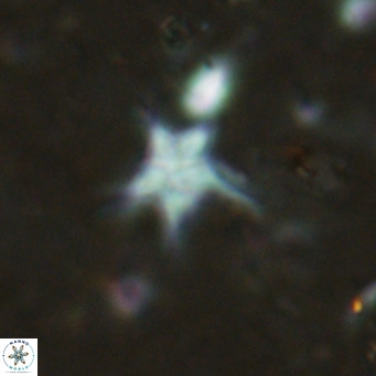 Discoaster asymmetroivrachiones VR 17844