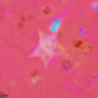 Discoaster asymmetroivrachiones VR 17848