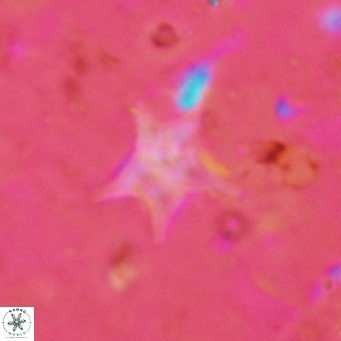 Discoaster asymmetroivrachiones VR 17848