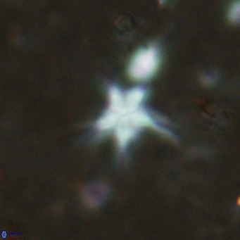 Discoaster asymmetroivrachiones VR 17849