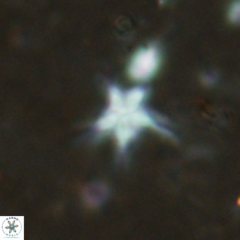Discoaster asymmetroivrachiones VR 17849