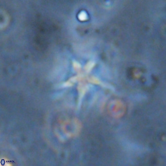 Discoaster asymmetroivrachiones VR 17836