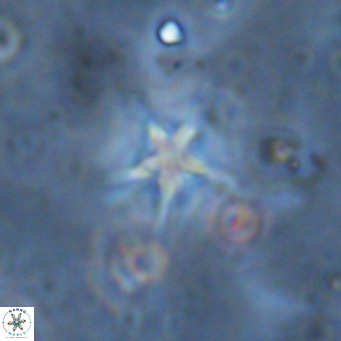 Discoaster asymmetroivrachiones VR 17836