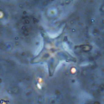 Discoaster asymmetroivrachiones VR 17842