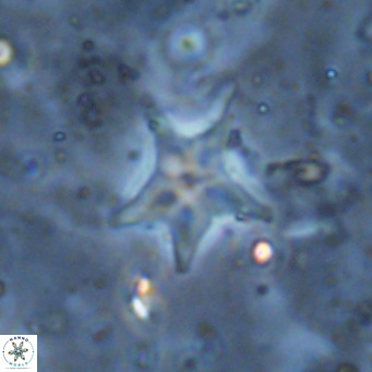 Discoaster asymmetroivrachiones VR 17842