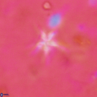 Discoaster asymmetroivrachiones VR 17836