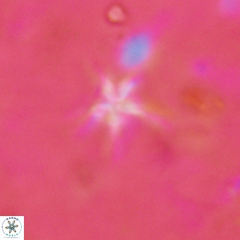 Discoaster asymmetroivrachiones VR 17836