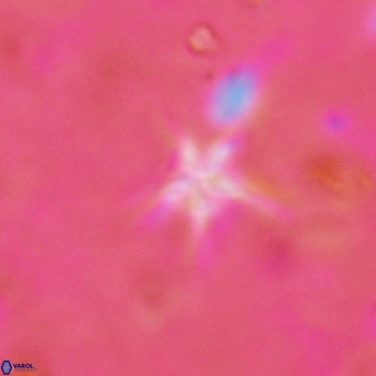 Discoaster asymmetroivrachiones VR 17850