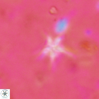 Discoaster asymmetroivrachiones VR 17850