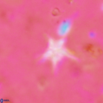 Discoaster asymmetroivrachiones VR 17851